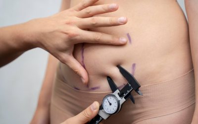 Is Awake Liposuction Safe? What San Antonio Patients Should Know Before Booking