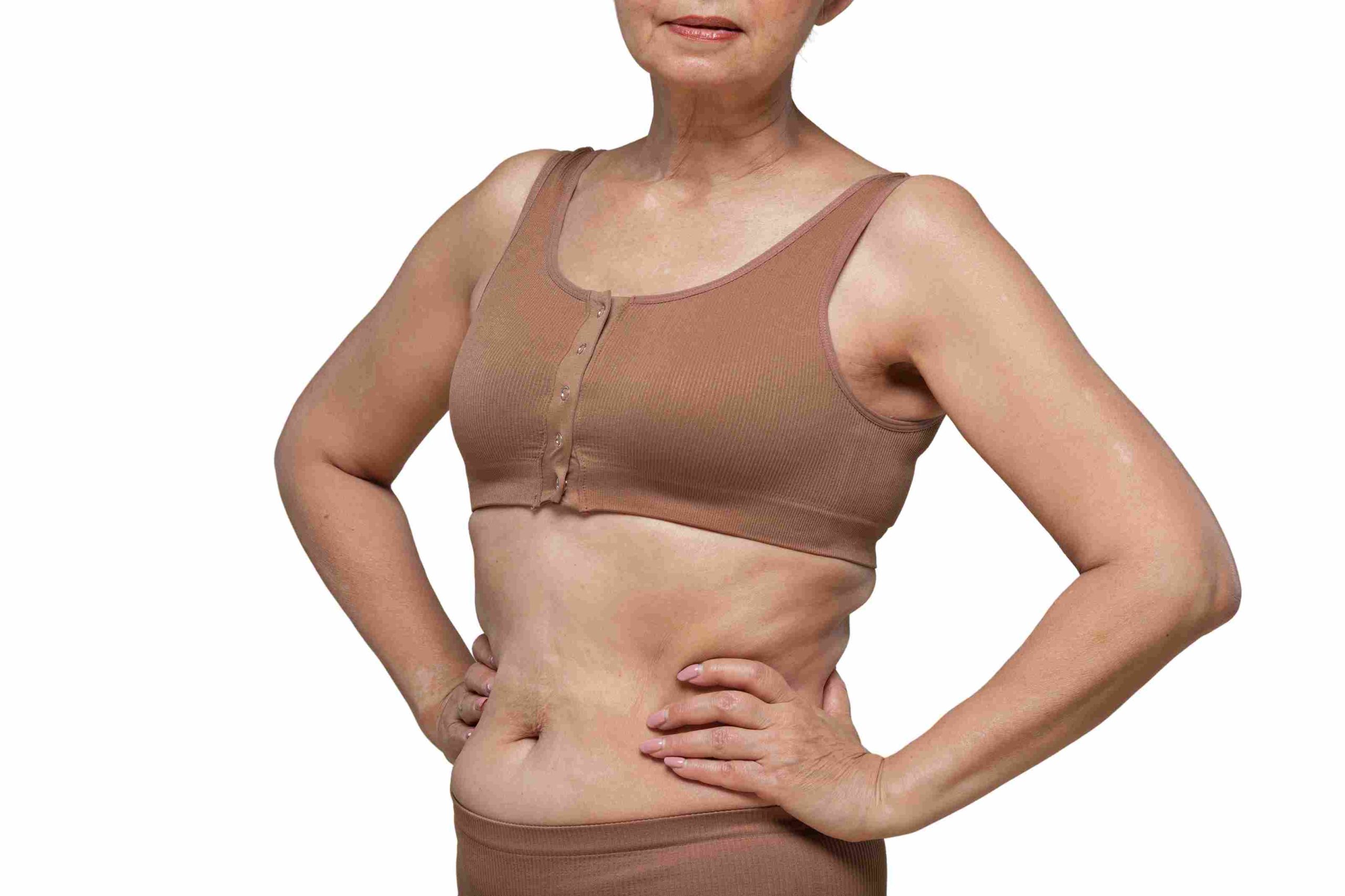 mons lift – eterna cosmetic surgery mons lift - eterna cosmetic surgery