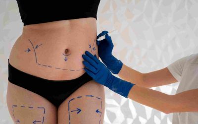 VaserLipo vs Liposuction: Which Body Contouring Procedure is Right for You?