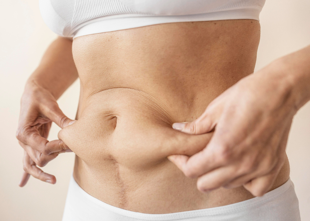 tummy tuck – Eterna Cosmetic Surgery tummy tuck - Eterna Cosmetic Surgery