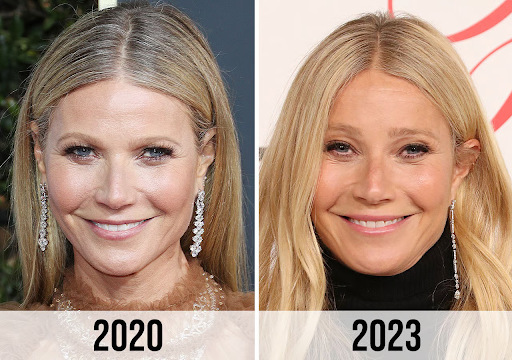 Gwyneth Paltrow Eterna Cosmetic Surgery 1 - Eterna Cosmetic Surgery Gwyneth Paltrow - Eterna Cosmetic Surgery