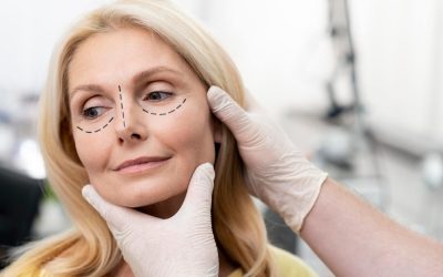 Suture Suspension Facelift: Non-Surgical Facial Lifting at Eterna