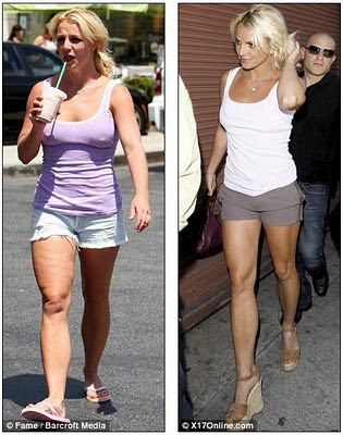 Britney Spears - Eterna Cosmetic Surgery