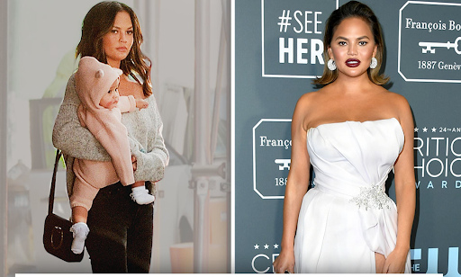 Chrissy Teigen Eterna Cosmetic Surgery 2 - Eterna Cosmetic Surgery Chrissy Teigen - Eterna Cosmetic Surgery