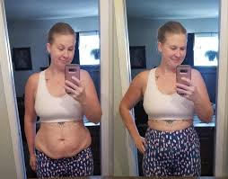 Kelly Stafford Eterna Cosmetic Surgery - Eterna Cosmetic Surgery Kelly Stafford - Eterna Cosmetic Surgery